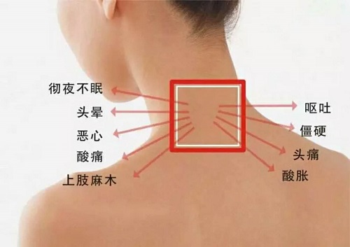 你的頸椎還健康嗎？