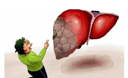 頭部出現(xiàn)這4種狀況，就要注意你的肝了！
